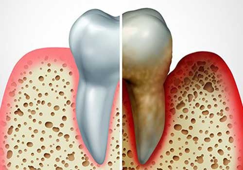 Quiet teeth, bold smiles: invisible aligners in Rajkot that actually fit life Quiet teeth, bold smiles: invisible aligners in Rajkot that actually fit life