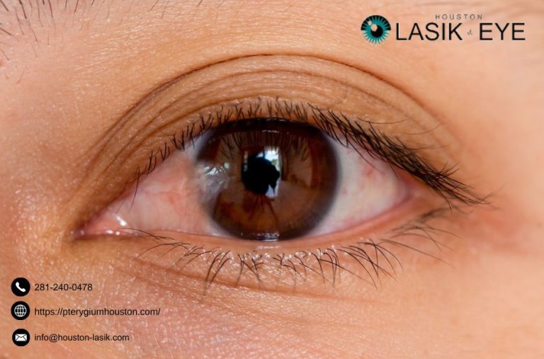 Practical guide to removing pterygium and eye surgery options