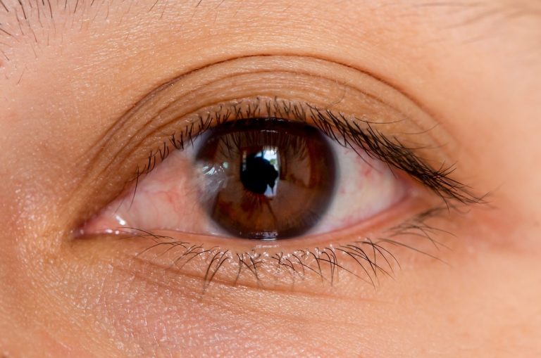 Understanding Eye Surgery Costs in Houston