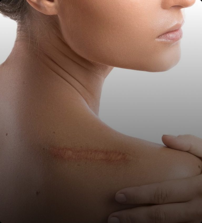 Enhancing Confidence with a Breast Lift in Malaysia
