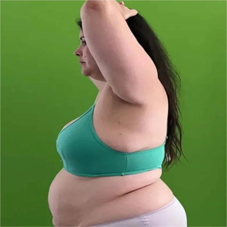 A Practical Guide to GLP-1 Weight Loss Treatments in Malaysia