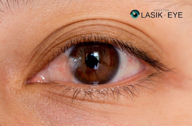Safe Ways to Treat Pterygium Symptoms at Home