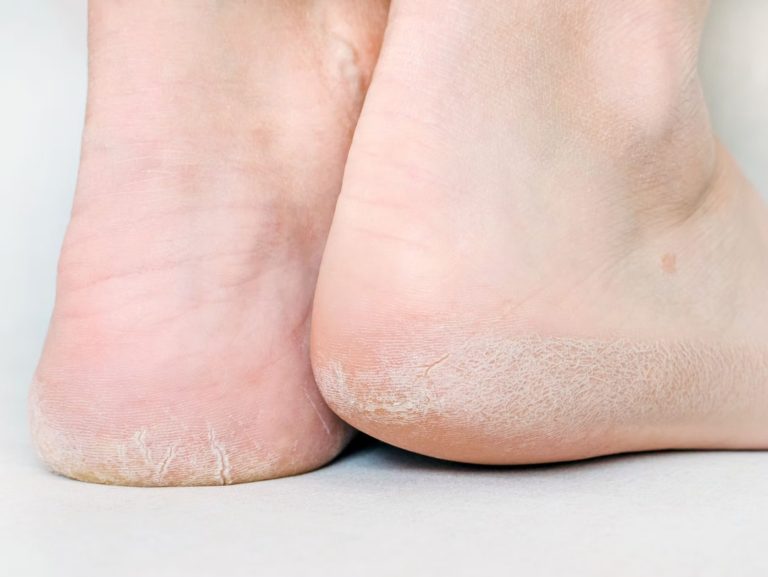Practical Care for Ankle Injury and Ligament Recovery