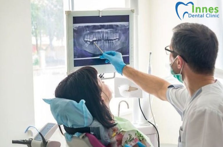 Wisdom Teeth Help in Orleans: Practical Guide