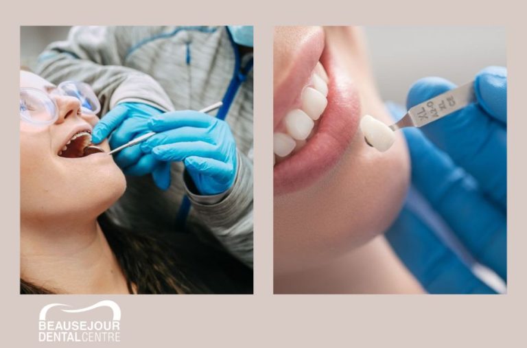 Practical guides for staying on top of dental health in Canada