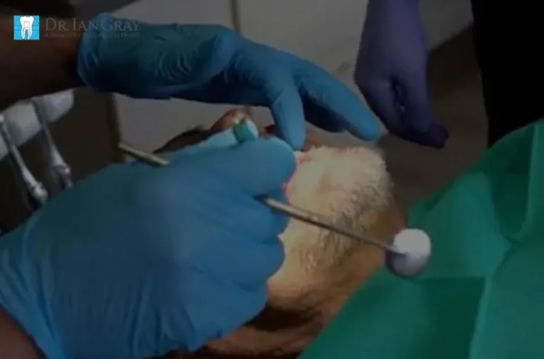 Effective Sedation Options for Anxious Patients in Newmarket at Dr. Ian Gray Dental Group