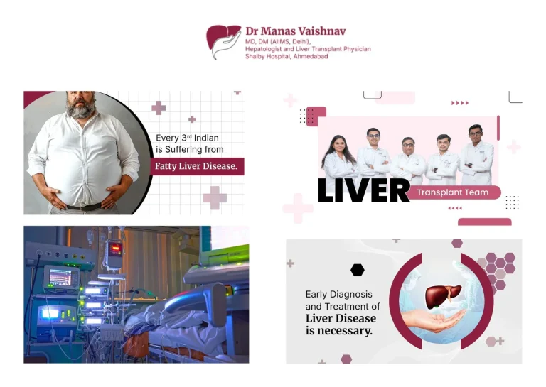 Expert Liver Transplant in Gujarat | Comprehensive Care and Support in Ahmedabad