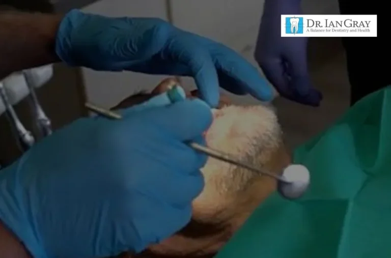 Expert Crowns and Bridges Newmarket for Durable and Natural-Looking Dental Restorations