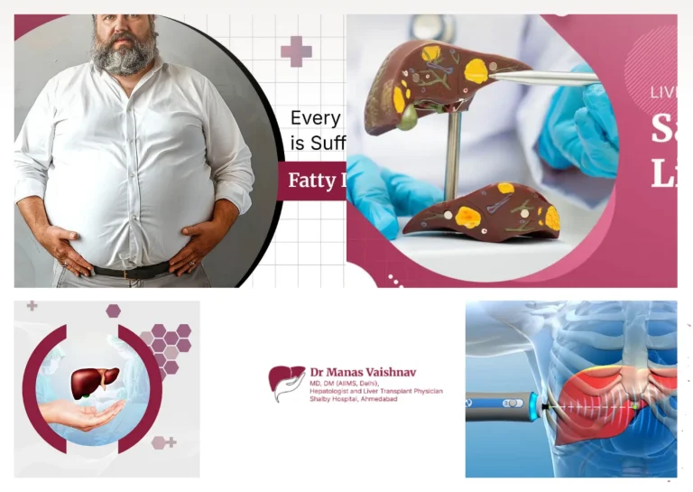 Best Gastroenterologist Ahmedabad for Expert Liver, Pancreatic, and GI Care