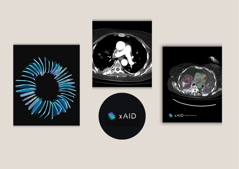 How to Choose Trusted Teleradiology Partners for CT How to Choose Trusted Teleradiology Partners for CT