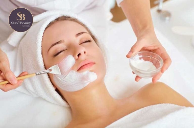 Guide to Micro Needling for Acne Scars in Australia